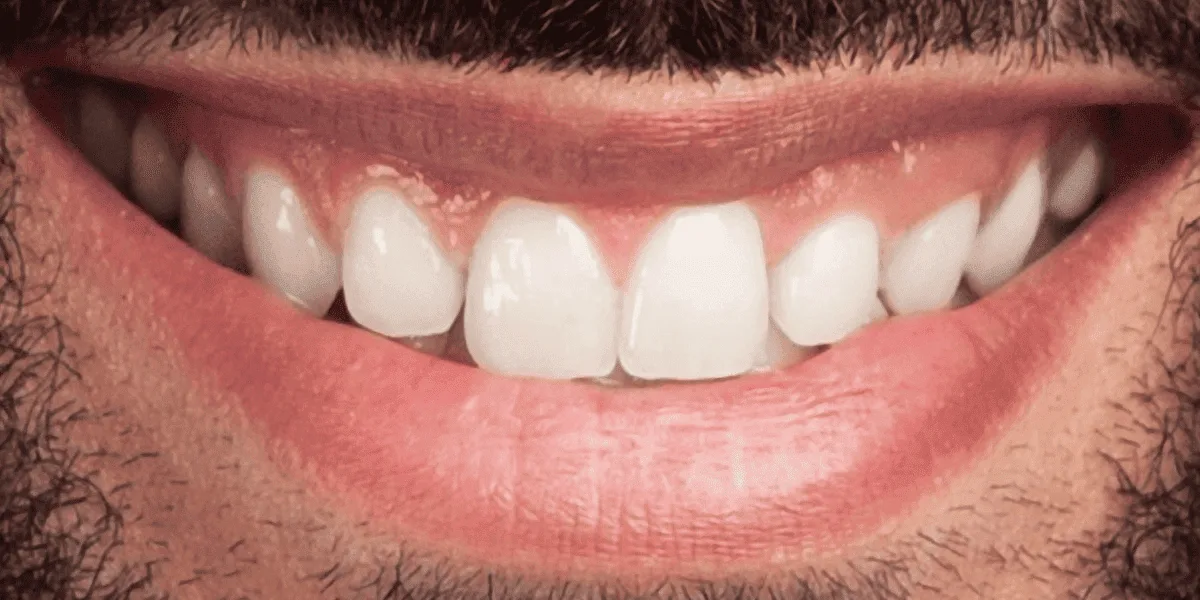 dental clinic in ahmedabad