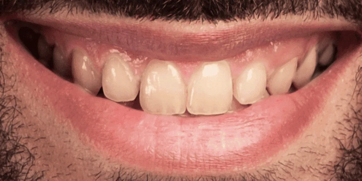 dental clinic in ahmedabad